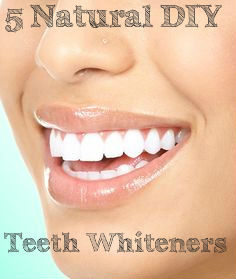 DIY Teeth Whitening Tips